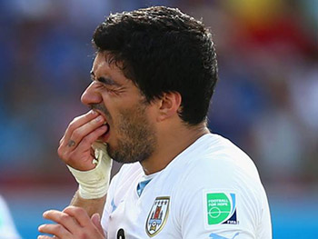 Suarez-teeth-betsson